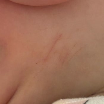 Bebek Tulumunda Güvenlik Açığı Nedeniyle Fiziksel Zarar