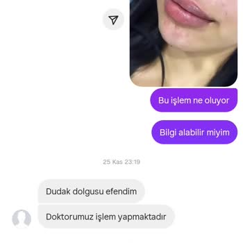 Esteva Güzellik Salonu'nda Randevu Problemleri Ve Hizmet Yetersizliği