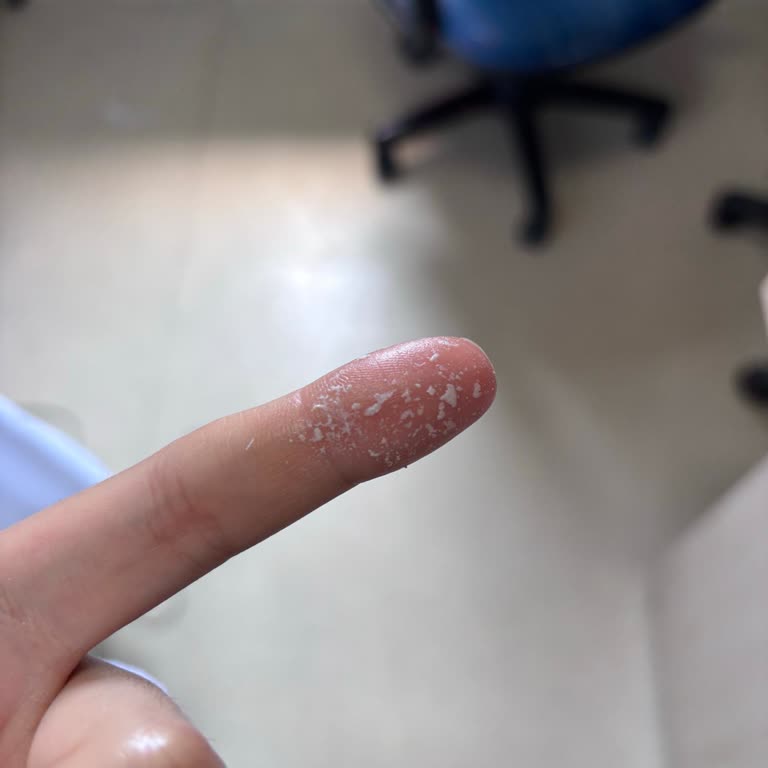 Bioderma Pigmentbio Krem Yüzümde Pul Pul Dökülüyor