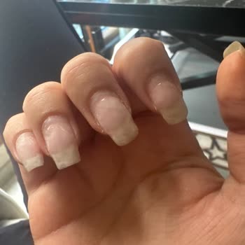 Randevu Gecikmesi Ve İlgisiz Hizmet Nedeniyle Mağduriyet Yaşadım