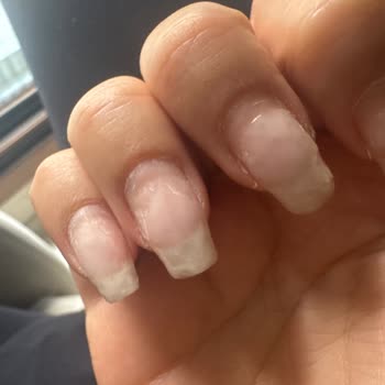 Randevu Gecikmesi Ve İlgisiz Hizmet Nedeniyle Mağduriyet Yaşadım