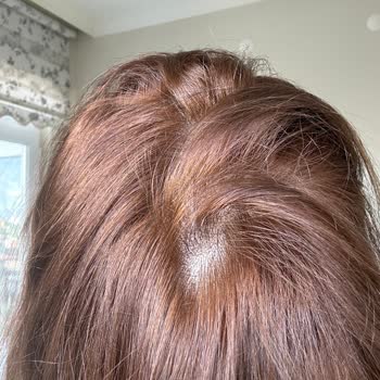 Loreal Excellence 7.11 İle Saçım Turuncuya Döndü, Hayal Kırıklığına Uğradım