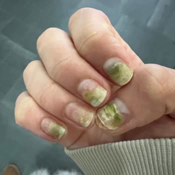 Hadise İdi Protez Tırnak Mağduriyeti!