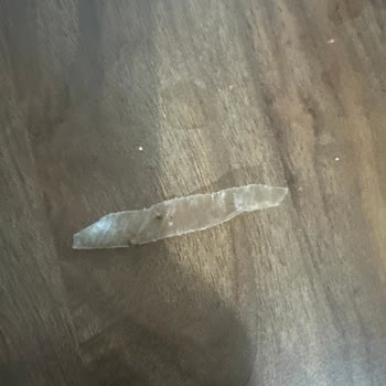 Sarma İçinden Plastik Çıktı, Sağlığım Tehlikeye Girdi