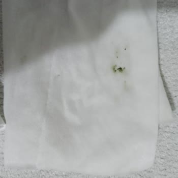 Küflü Sleepy Yenidoğan Islak Havlu Sağlık Riski Yarattı