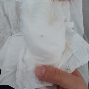 Aldığım Bebek Bezinde Sert Maddeler Çıktı, Sağlık Riski Oluşturuyor