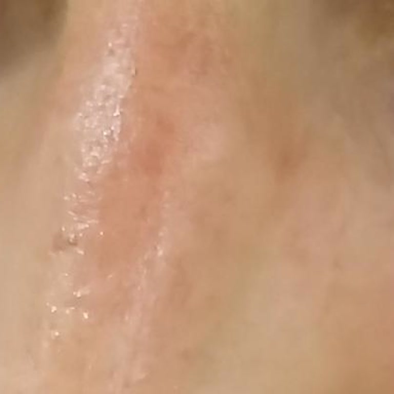 Bioderma Pigmentbio Güneş Kremi Eşimde Cilt Sorunlarına Yol Açtı