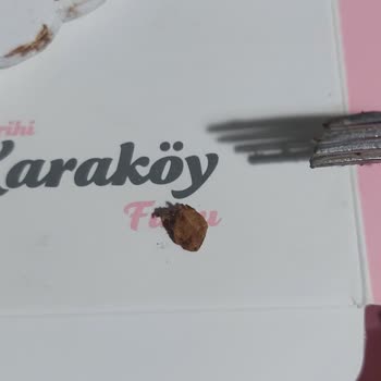 Aldığım Pastadan Taş Çıktı, Sağlığım Tehlikeye Girdi