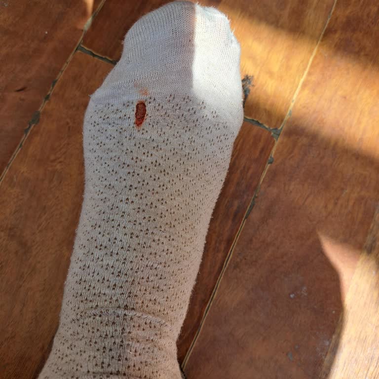 FLOdan Aldığım Ayakkabı Ayağımı Yaraladı Değişim Yapılmıyor