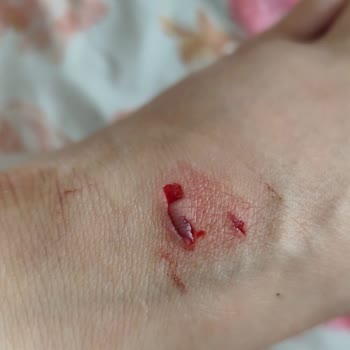 Bosch Fırının Camı Patladı, Güvenlik Riski Oluştu