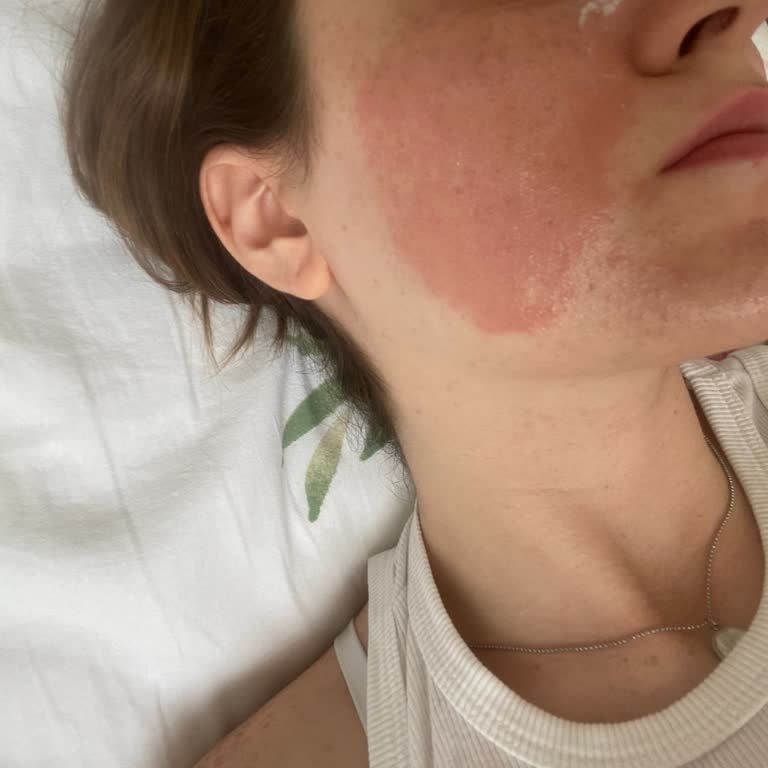 The Purest Glikolik Asit Ve C Vitamini Ürünü Cildimde Alerjik Reaksiyona Sebep Oldu