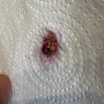 BİM Mutfağım Dondurulmuş Orman Meyveleri İçinden Salyangoz Çıktı