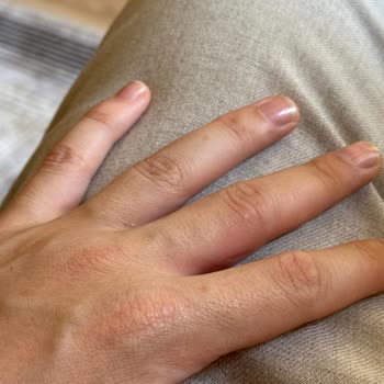 Adam Deodorant Kapak Sorunu Ve Cilt Tahrişi