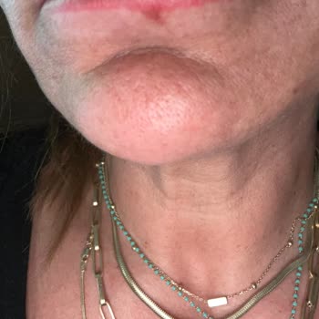 Uzman Eksikliği Ve Başarısız İşlemlerle Hayal Kırıklığı