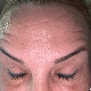 Uzman Eksikliği Ve Başarısız İşlemlerle Hayal Kırıklığı