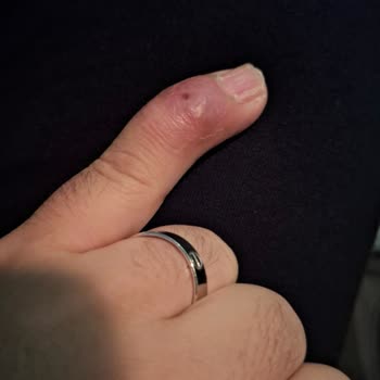 Sigorta Ameliyat Masraflarımı Karşılamadı, Mağdur Oldum