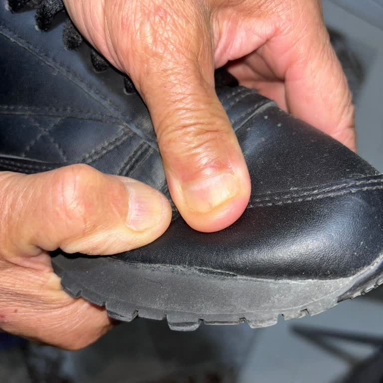 Az Kullanılmış Reebok Ayakkabının Yanlarından Açılması Ve Çözüm Bekleyişi