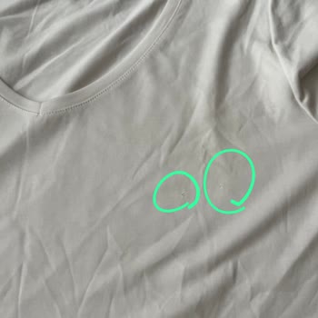 İnceleme Sonrası Daha Da Zarar Gören Tişörtte Kullanıcı Hatası Denmesi Mağduriyet Yarattı