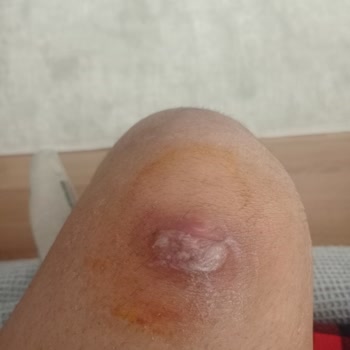 Çocuğumun Sağlık Sorununa Çözüm Bulunamıyor: Sürekli Yönlendirme Ve İlgisizlik