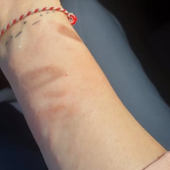 Alerjiye Neden Olan Krem Sonrası İlgisiz Müşteri Hizmetleriyle Mağduriyet Yaşadım