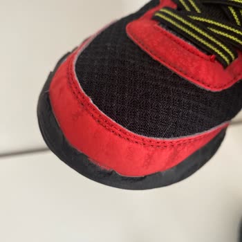 Aynı Model Ayakkabıda Tekrarlayan Soruna Çözüm Yok!