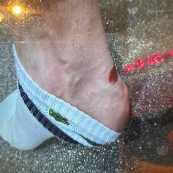 Yeni Alınan Ayakkabının Süet Kısmında Solma Ve Yara Problemi