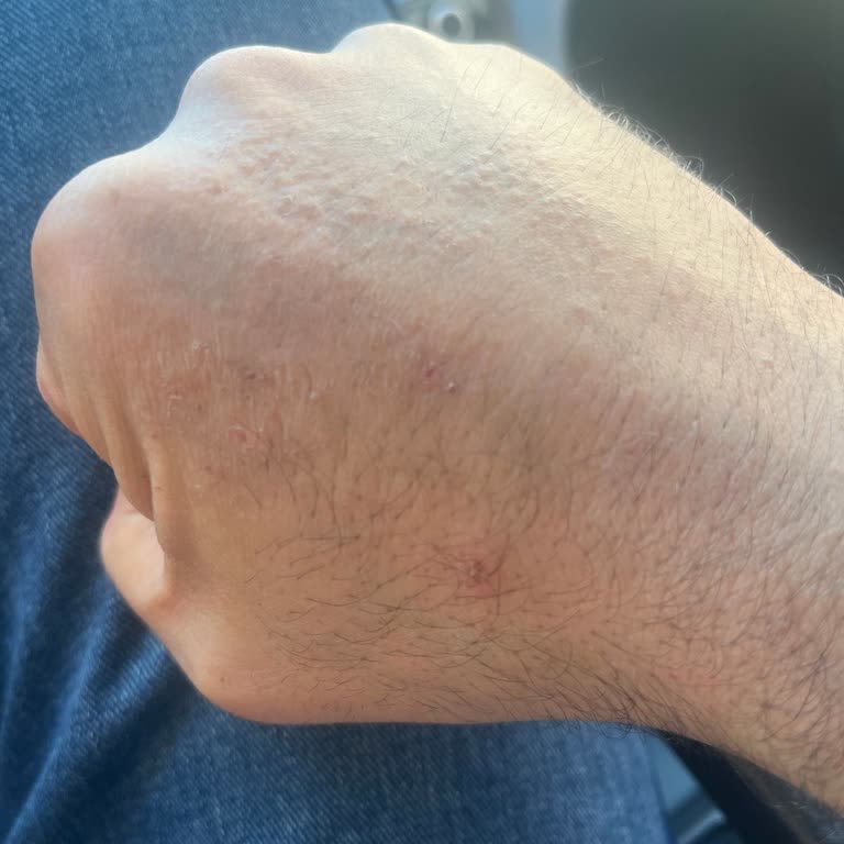 Krem Yan Etkisine Rağmen Ücretsiz Danışma Yapılmadı