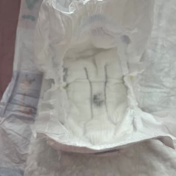 Черные точки на подгузнике Molfix – прошу разъяснить причину