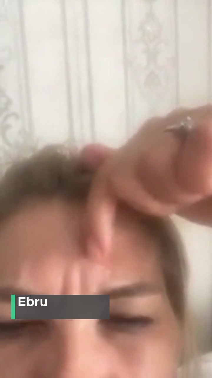 Doç. Dr. Hülya Nazik Dermatoloji Ve Kozmetik Kliniği Eskisinden Daha Kötü videonun kapak resmi