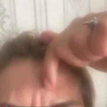 Doç. Dr. Hülya Nazik Dermatoloji Ve Kozmetik Kliniği Eskisinden Daha Kötü