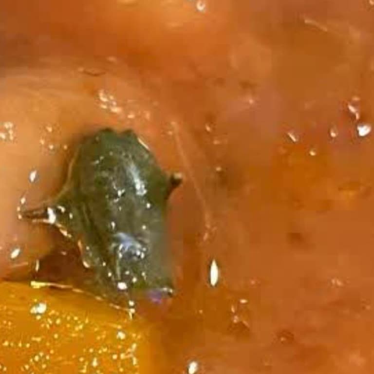 Konserve İçerisinde Yabancı Cisimle Karşılaşılması Ve Sağlık Riski