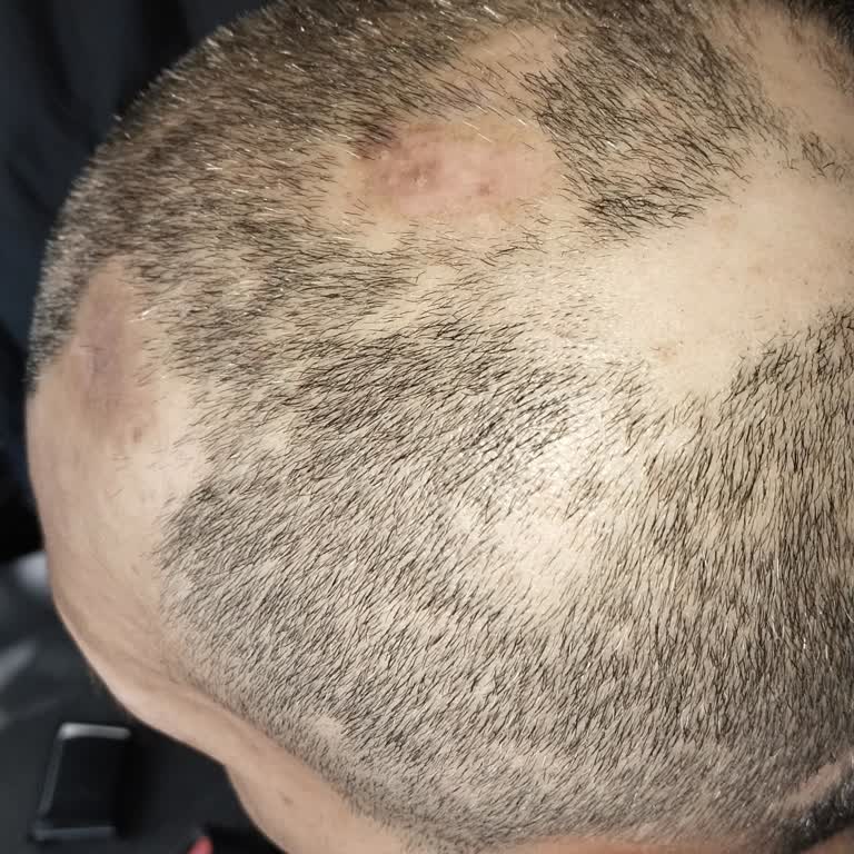 MHRS Randevu Alımında Ve Doktor Yönlendirmelerinde Süreğen Sorunlar