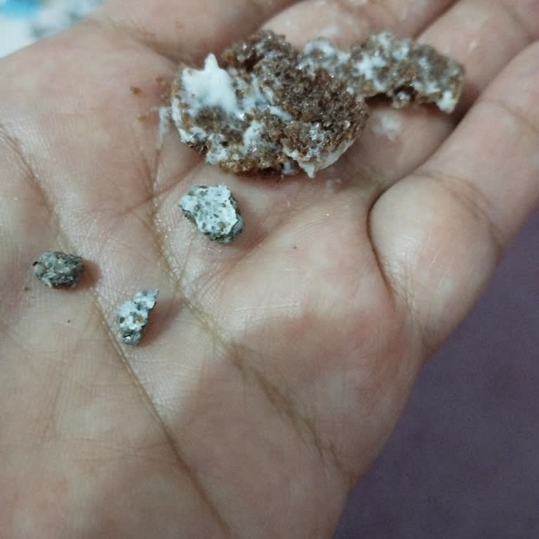 Kinder Süt Diliminden Taş Çıkması Ve Çocuğumun Sağlığına Tehlike