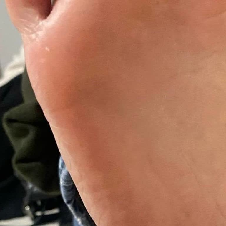 Aldığım Ayakkabı Ayağımı Mahvetti Mağaza İlgisiz Ve Kaba Davrandı