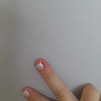 Protez Tırnak Sonrası Enfeksiyon Ve Hijyen Eksikliği Şok Etti