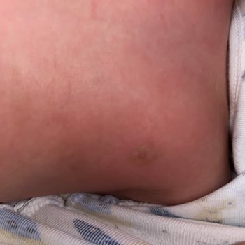 Sek Quark Tüketimi Sonrası Bebeğimde Sağlık Sorunları Yaşandı