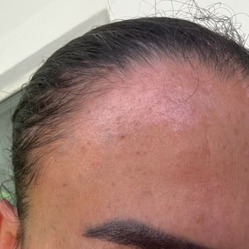 Fatih Sarıkaya Kuaför'de İşlem Sonuçları Korkunç