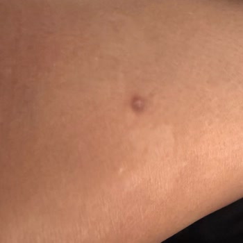 Fatih Sarıkaya Kuaför'de İşlem Sonuçları Korkunç