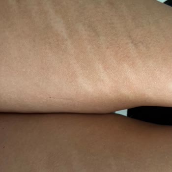 Fatih Sarıkaya Kuaför'de İşlem Sonuçları Korkunç