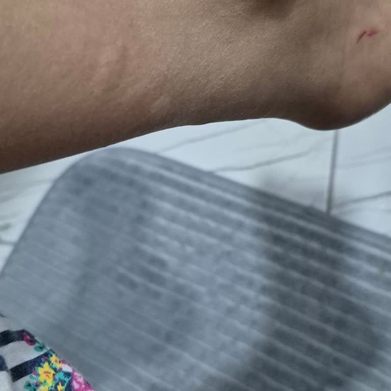 Yetersiz İlaçlama Nedeniyle Böcek Sorunu Ve Yaşam Kalitesinin Düşmesi