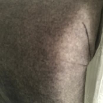 Baza Değişim Sürecinde Aylardır Çözüm Alamadım