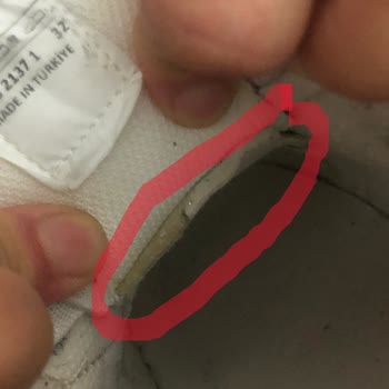 Çocuğumun Ayakkabısındaki Üretim Hatası Defalarca Reddedildi, Mağduriyetimiz Giderilmiyor