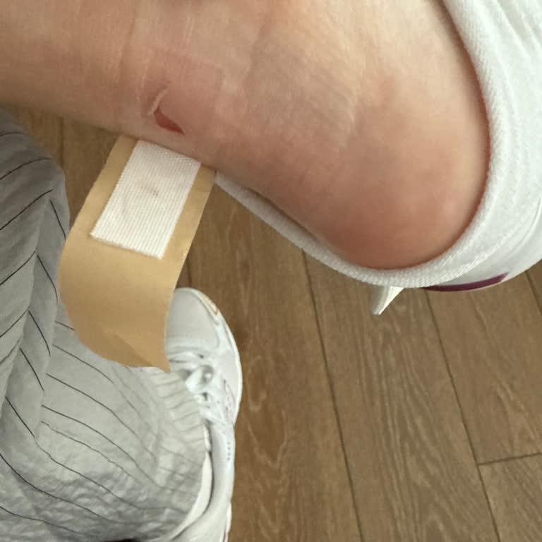 Adidas Samba Ayakkabı Ayağımı Yaraladı