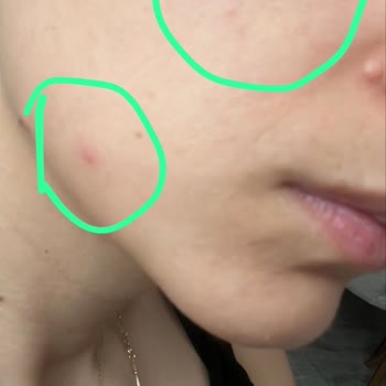 Loreal Renkli Güneş Kremi Cildimde Olumsuz Sonuçlar Yarattı