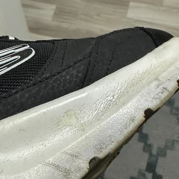 Skechers Ayakkabıda Erken Yıpranma Ve Üretim Hatası İddiası
