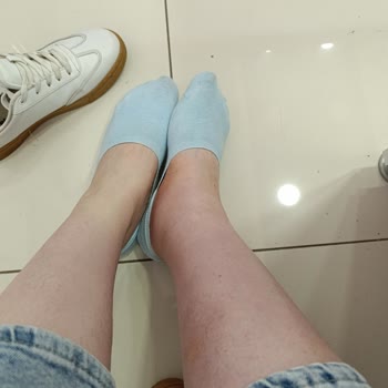 Yanıltıcı Varis Tedavisi Ve Maddi Zarar: Fatura Verilmedi, Sağlığım Bozuldu