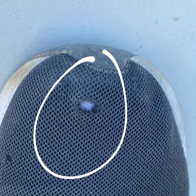 Adidas Bez Ayakkabıda Kısa Sürede Logo Kısmında Açılma Ve Yırtık