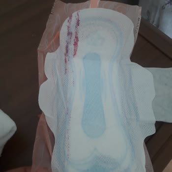 Orkid Pedlerde Kırmızı Boya Şaşkınlığı: Sağlığımız Tehlikede Mi?