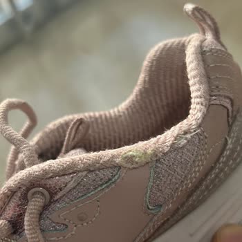 Skechers Ayakkabıda Dikiş Sökülmesi Ve Kullanıcı Hatası Yanıtı Mağduriyeti