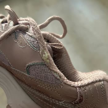 Skechers Ayakkabıda Dikiş Sökülmesi Ve Kullanıcı Hatası Yanıtı Mağduriyeti